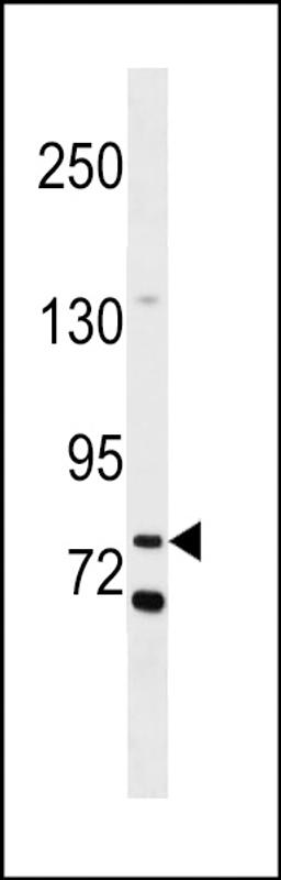 Western blot analysis in MDA-MB453 cell line lysates (35ug/lane).