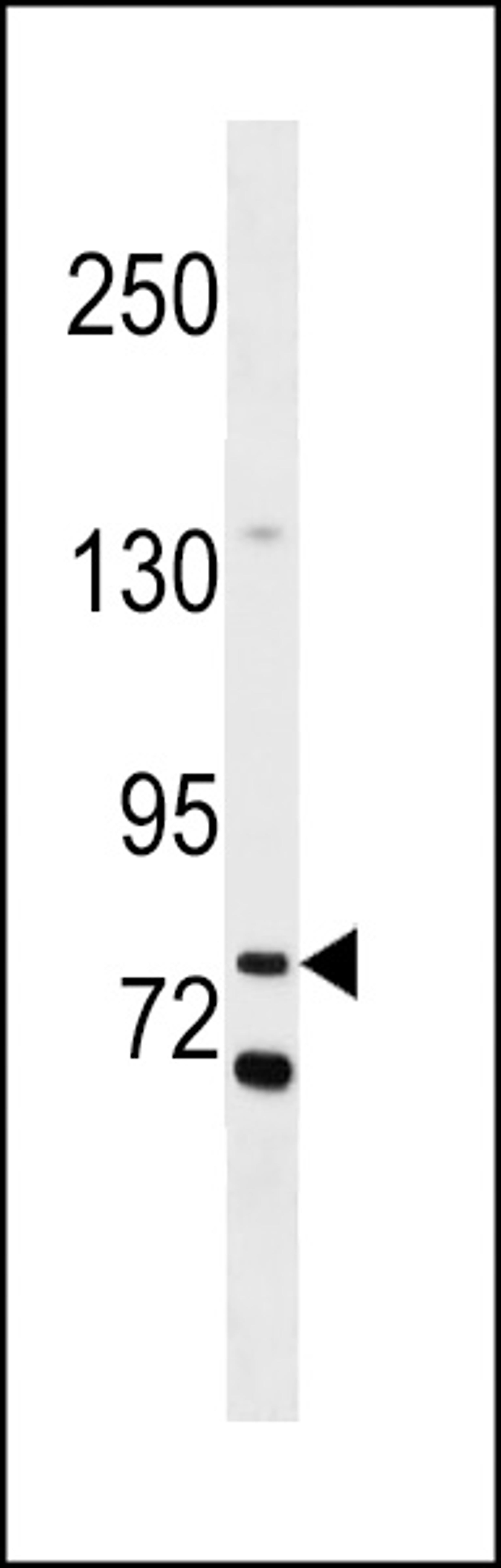 Western blot analysis in MDA-MB453 cell line lysates (35ug/lane).