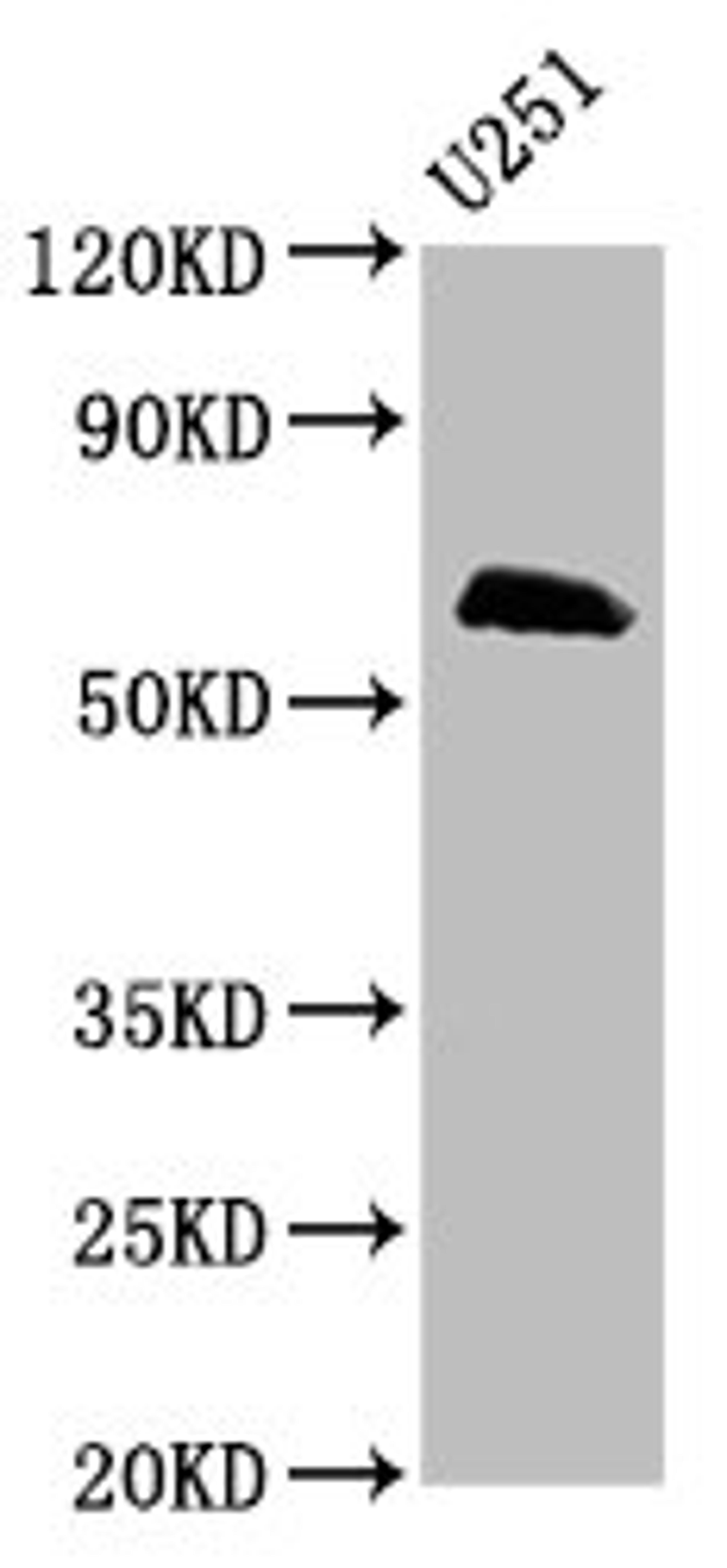 Western Blot. Positive WB detected in: U251 whole cell lysate. All lanes: MSL2 antibody at 5µg/ml. Secondary. Goat polyclonal to rabbit IgG at 1/50000 dilution. Predicted band size: 63, 55 kDa. Observed band size: 63 kDa