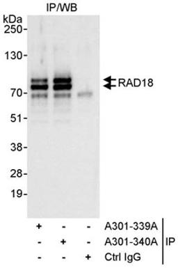 Detection of human RAD18 by western blot of immunoprecipitates.