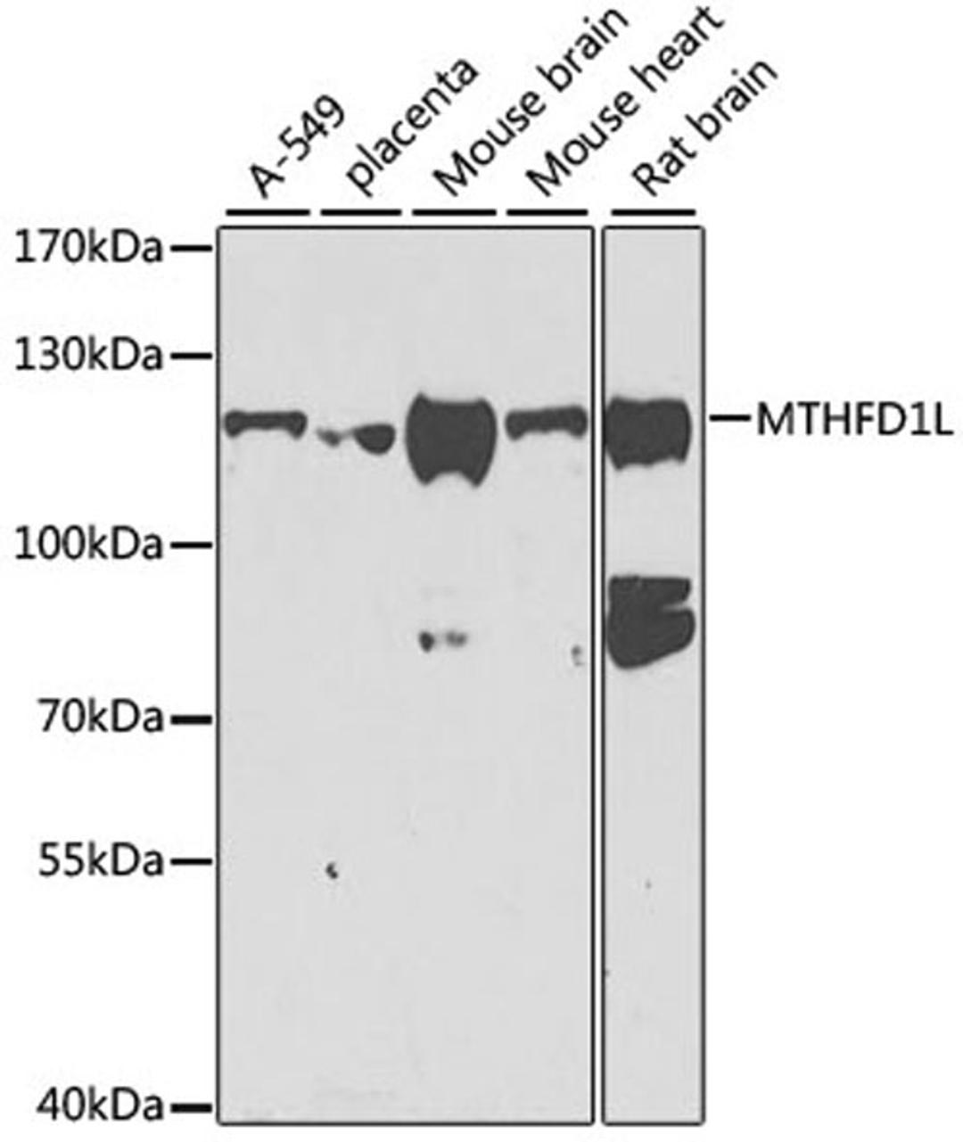 Western blot - MTHFD1L antibody (A7969)