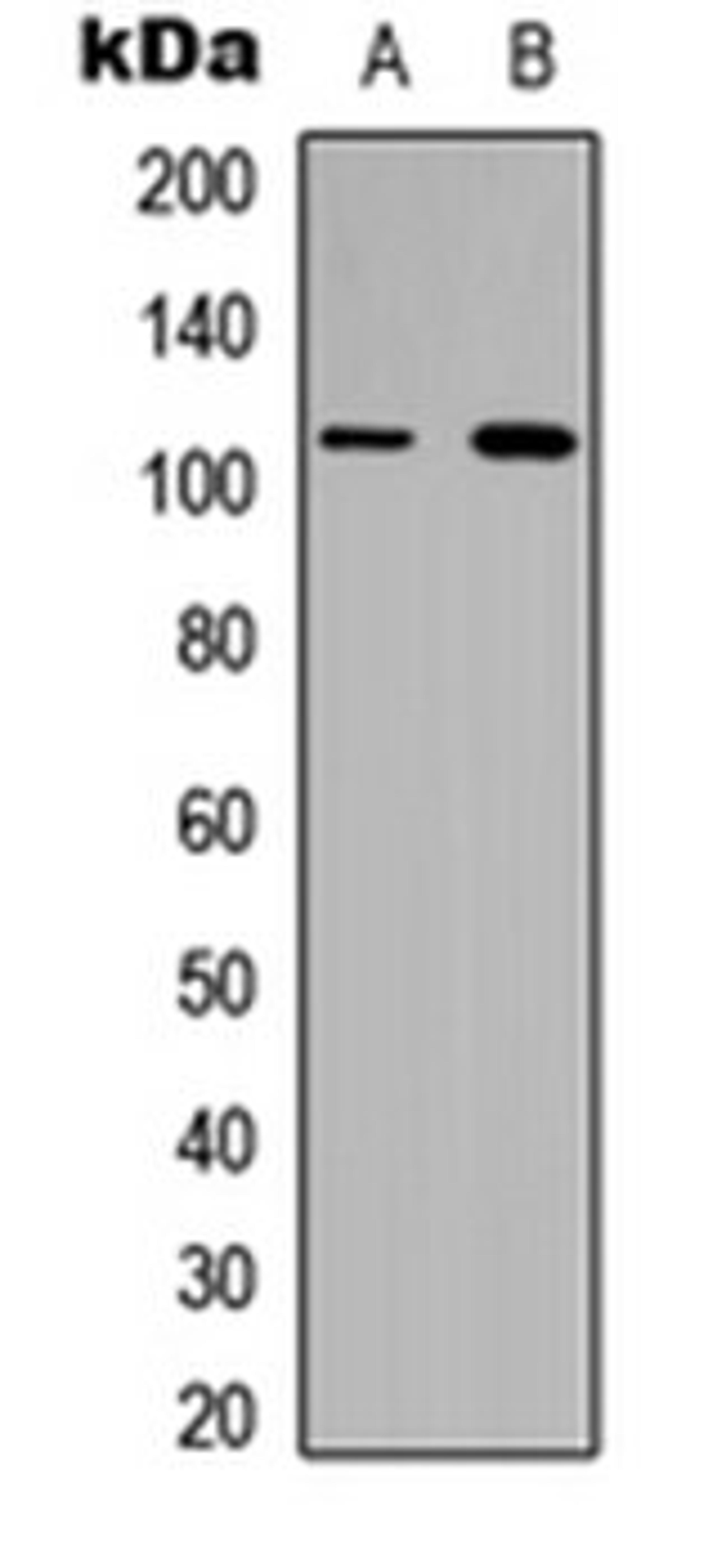 Western blot analysis of HeLa (Lane 1), H9C2 (Lane 2) whole cell lysates using Collagen 6 alpha 1 antibody