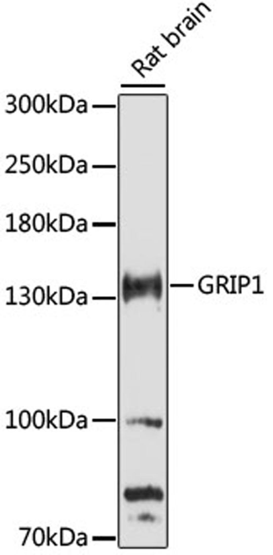 Western blot - GRIP1 antibody (A16503)