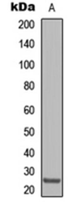 Western blot analysis of HepG2 (Lane 1) whole cell lysates using Claudin 8 antibody