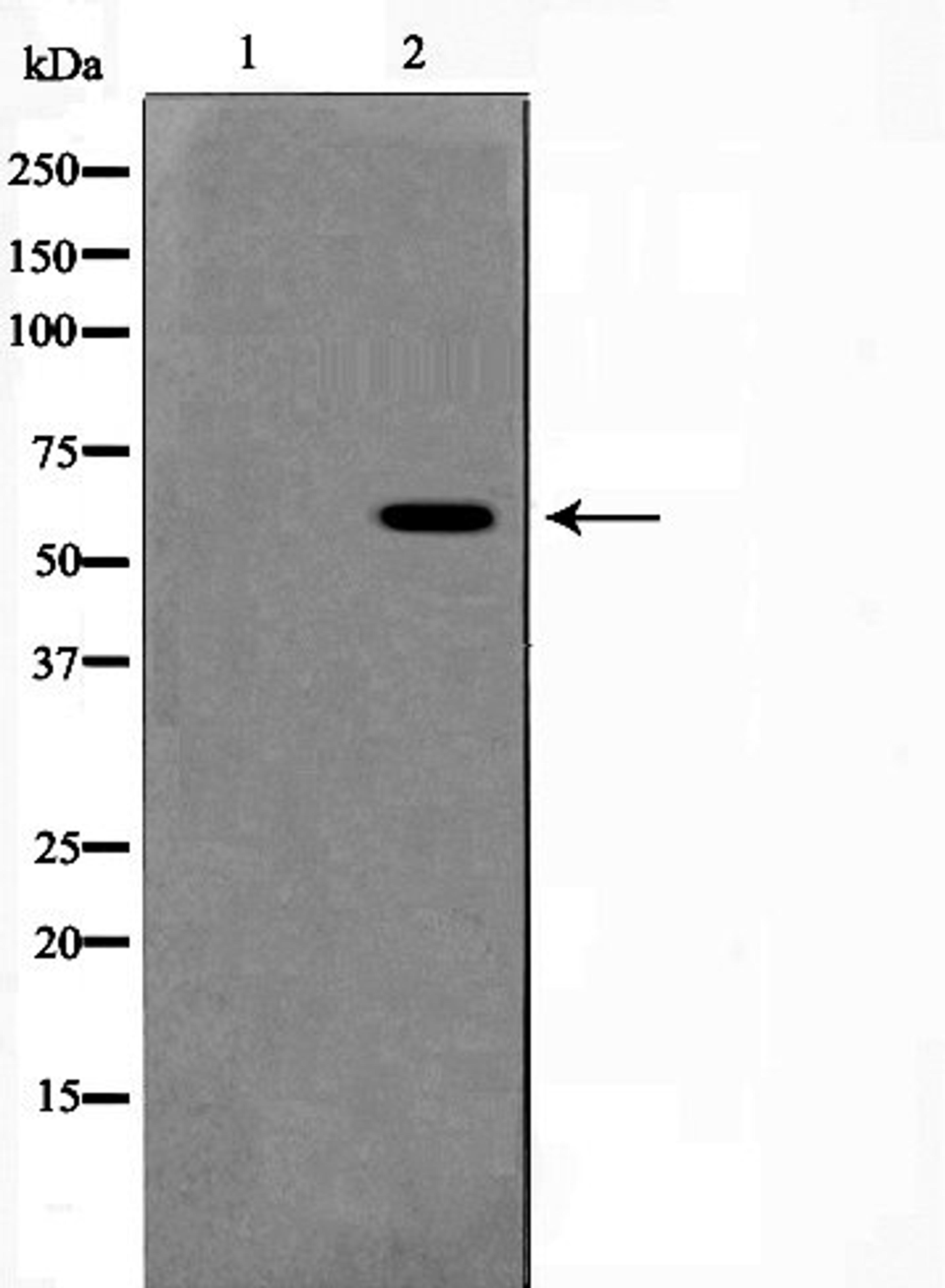 Western blot analysis of Jurkat cell lysate using ERK8 (Phospho-Thr175+Tyr177) antibody