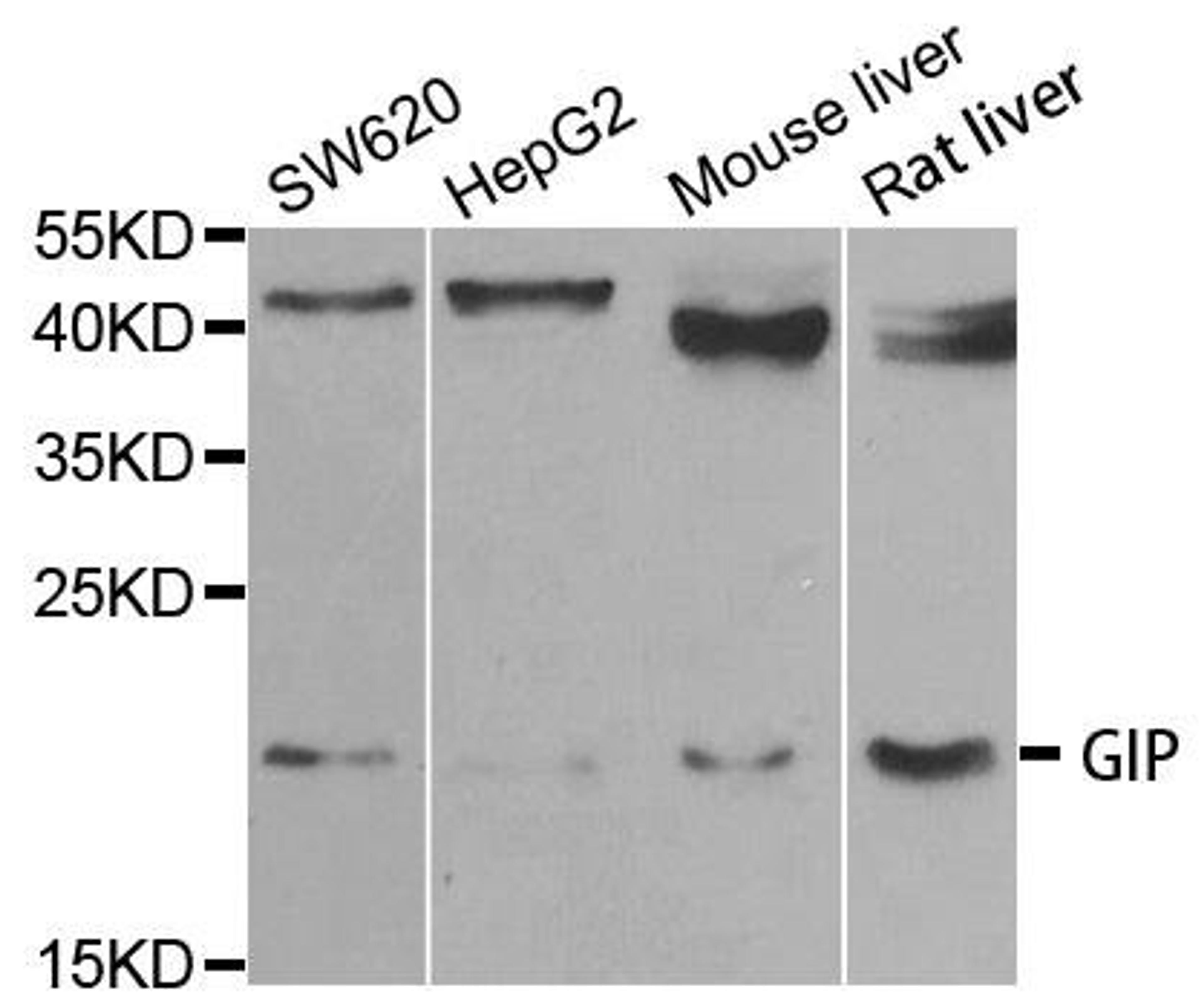 Western blot analysis of extracts of various cell lines using GIP antibody