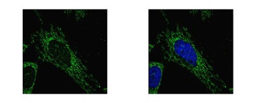 Immunocytochemistry/Immunofluorescence: SUCLG1 Antibody [NBP1-32728] - Sample: HeLa cells were fixed in 2% paraformaldehyde/culture medium at 37C for 30 min. Green: SUCLG1 protein stained by SUCLG1 antibody diluted at 1:500. Blue: Hoechst 33342 staining.