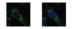 Immunocytochemistry/Immunofluorescence: SUCLG1 Antibody [NBP1-32728] - Sample: HeLa cells were fixed in 2% paraformaldehyde/culture medium at 37C for 30 min. Green: SUCLG1 protein stained by SUCLG1 antibody diluted at 1:500. Blue: Hoechst 33342 staining.