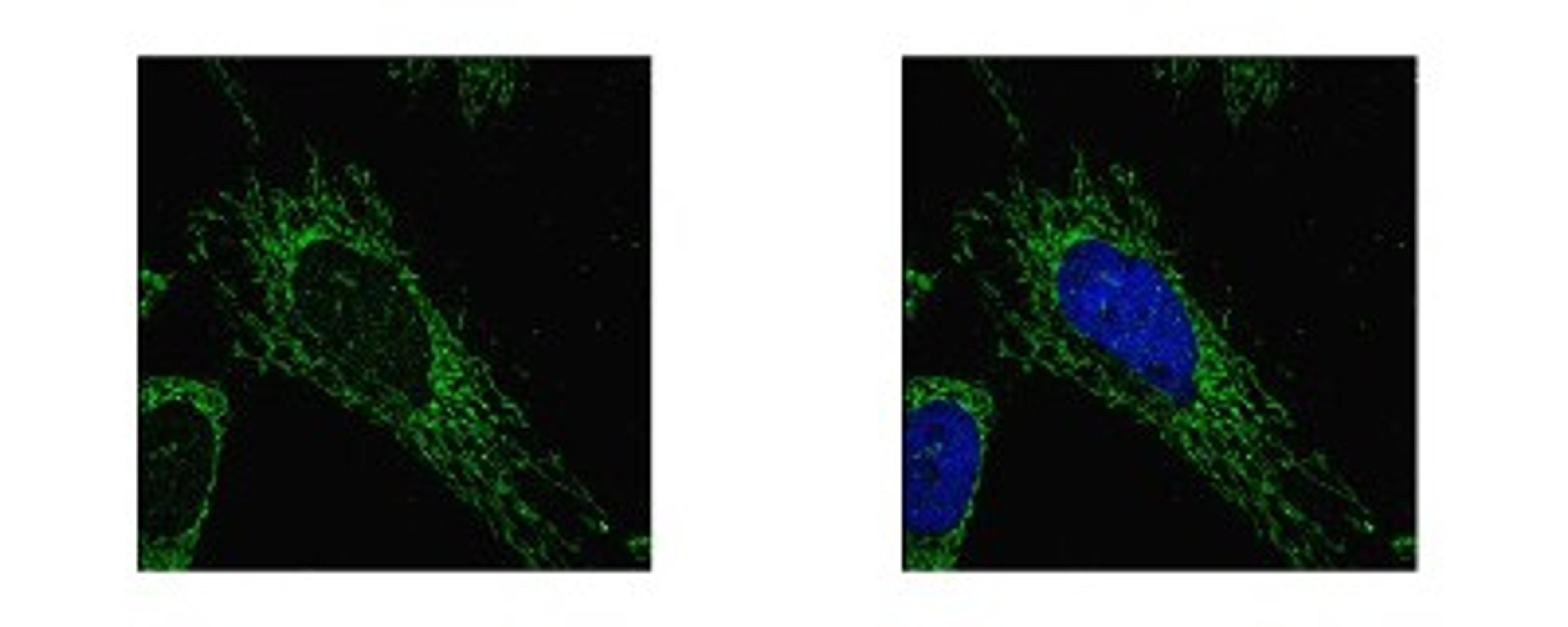 Immunocytochemistry/Immunofluorescence: SUCLG1 Antibody [NBP1-32728] - Sample: HeLa cells were fixed in 2% paraformaldehyde/culture medium at 37C for 30 min. Green: SUCLG1 protein stained by SUCLG1 antibody diluted at 1:500. Blue: Hoechst 33342 staining.