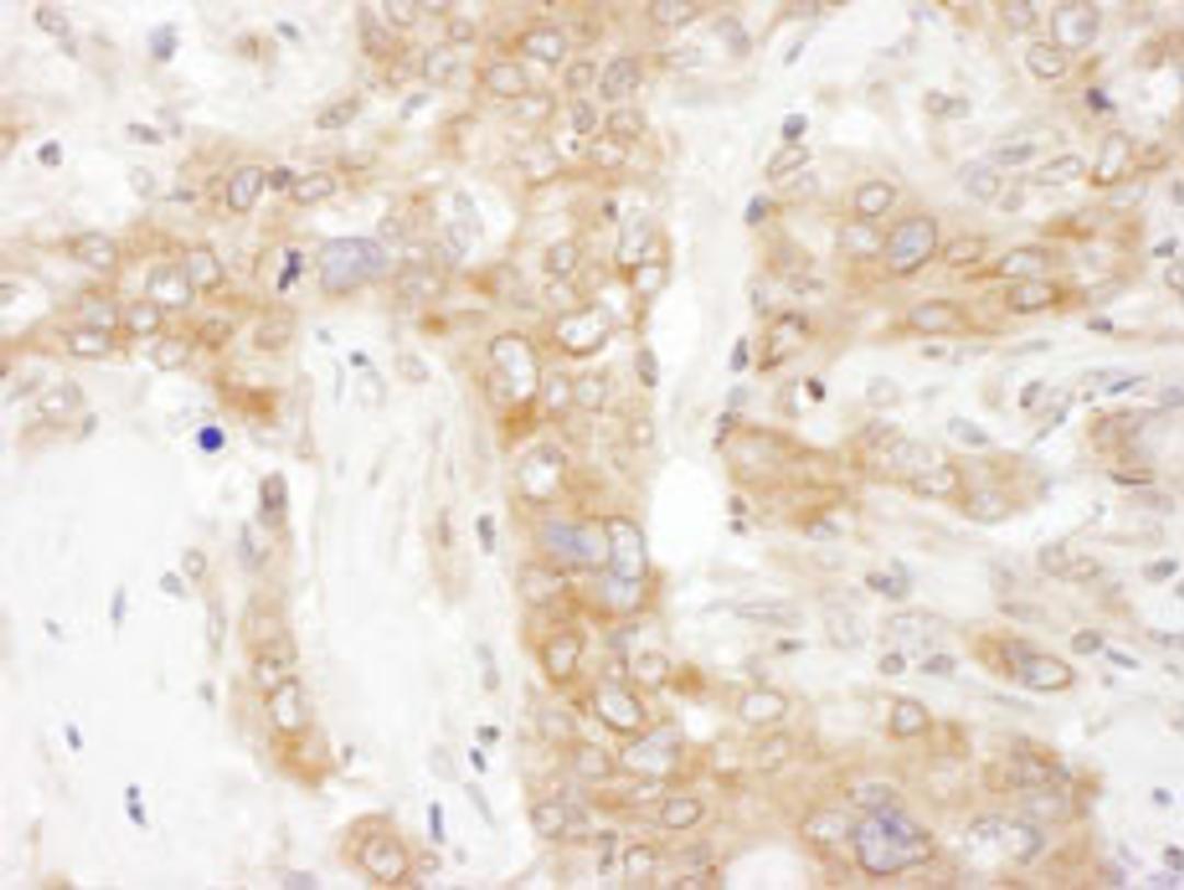 Detection of human VAP-33 by immunohistochemistry.