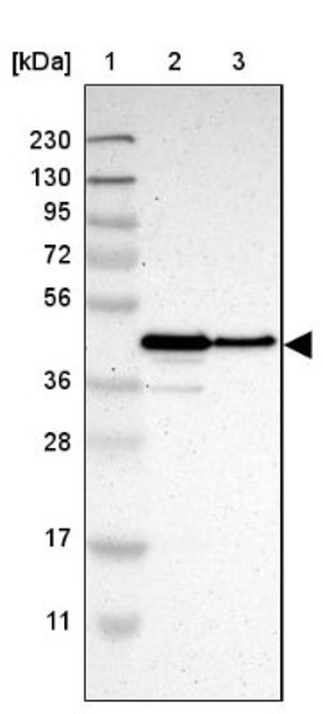 Western Blot: PAWR / PAR4 Antibody [NBP1-87338] - Lane 1: Marker [kDa] 230, 130, 95, 72, 56, 36, 28, 17, 11<br/>Lane 2: Human cell line RT-4<br/>Lane 3: Human cell line U-251MG sp