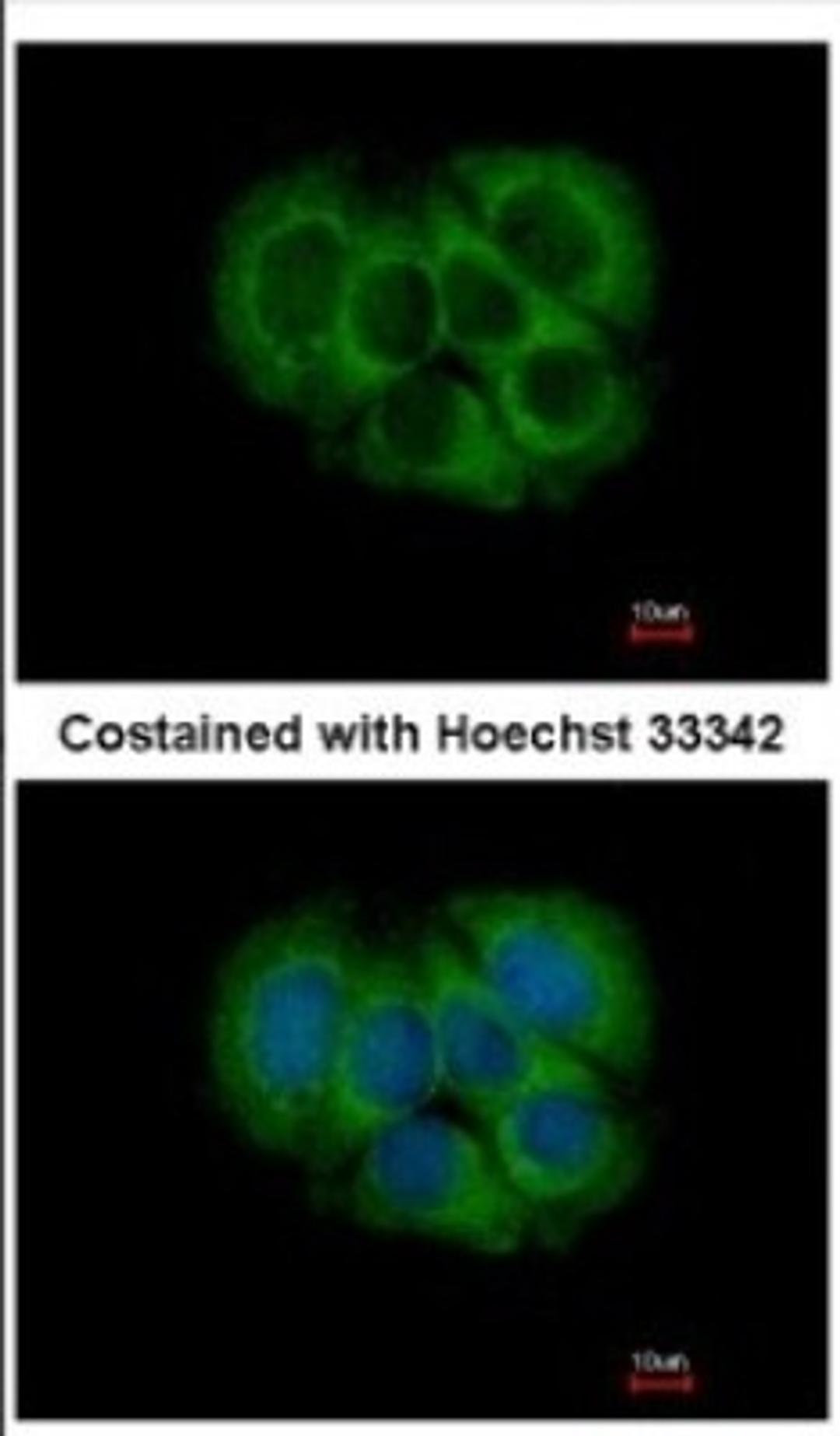 Immunocytochemistry/Immunofluorescence: FGFR1OP2 Antibody [NBP2-16479] - Immunofluorescence analysis of methanol-fixed MCF-7, using antibody at 1:500 dilution.