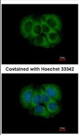 Immunocytochemistry/Immunofluorescence: FGFR1OP2 Antibody [NBP2-16479] - Immunofluorescence analysis of methanol-fixed MCF-7, using antibody at 1:500 dilution.