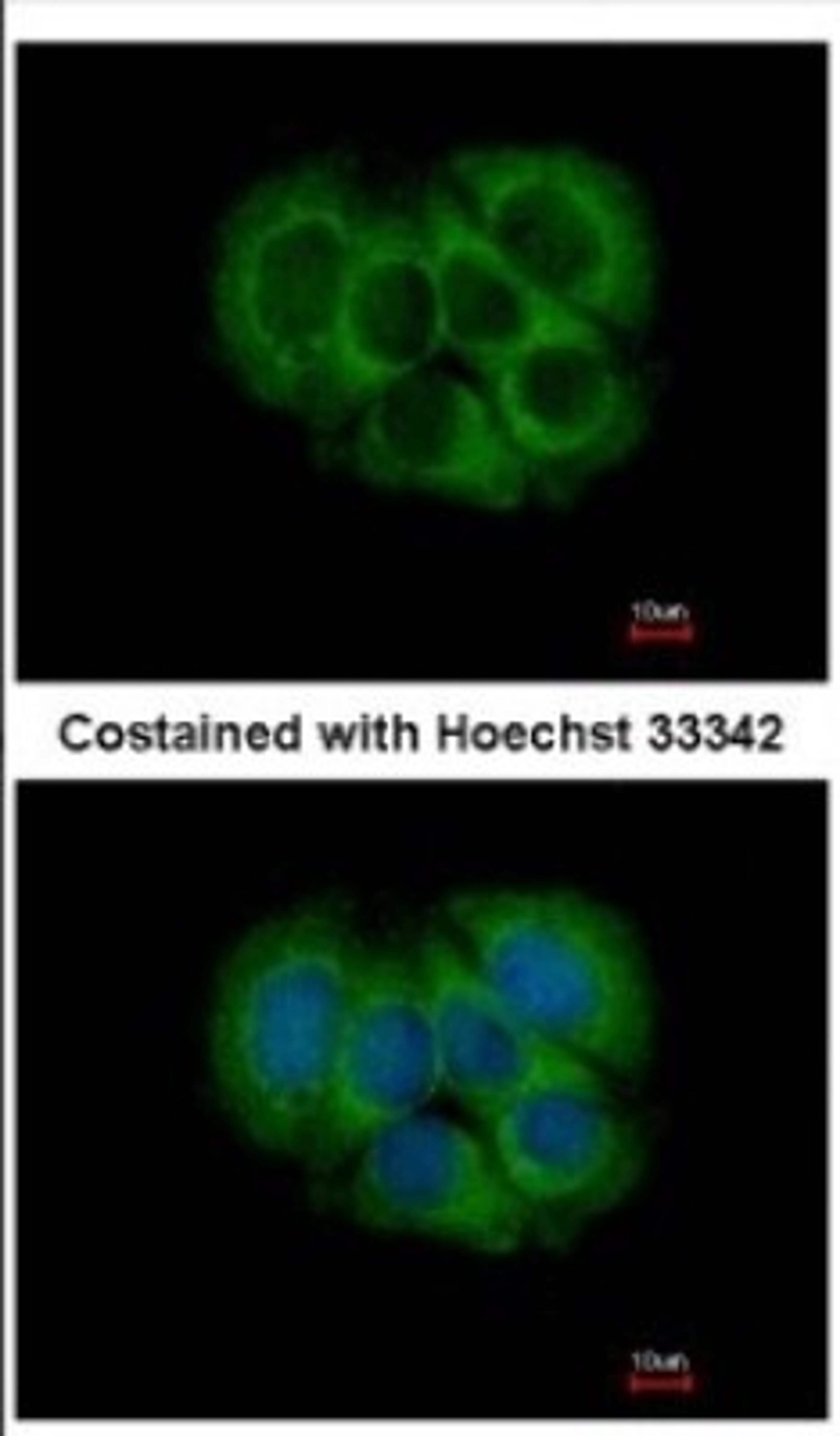 Immunocytochemistry/Immunofluorescence: FGFR1OP2 Antibody [NBP2-16479] - Immunofluorescence analysis of methanol-fixed MCF-7, using antibody at 1:500 dilution.