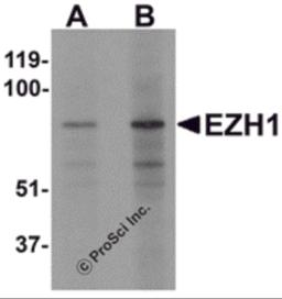 Western blot analysis of EZH1 in mouse lung tissue lysate with EZH1 antibody at (A) 1 and (B) 2 &#956;g/mL