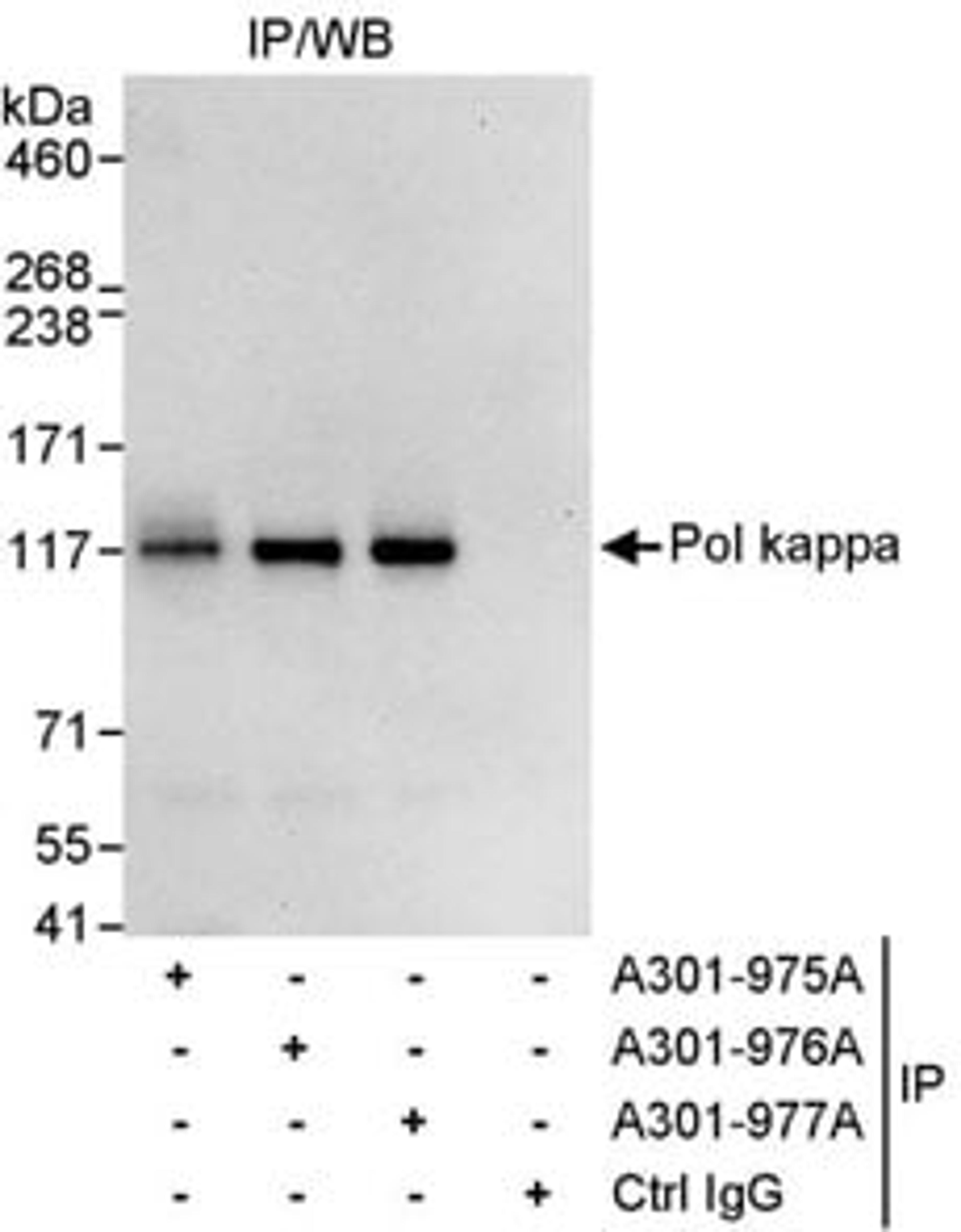 Detection of human Pol kappa by western blot of immunoprecipitates.