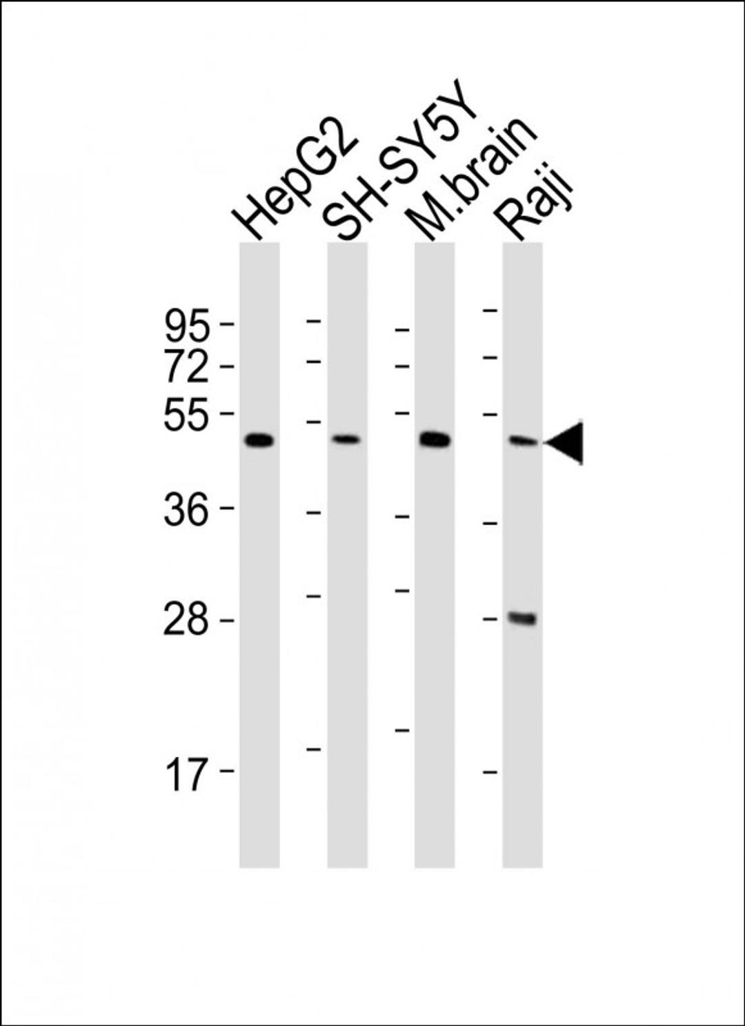 Western Blot at 1:2000 dilution Lane 1: HepG2 whole cell lysates Lane 2: SH-SY5Y whole cell lysates Lane 3: mouse brain lysates Lane 4: Raji whole cell lysates Lysates/proteins at 20 ug per lane.