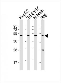 Western Blot at 1:2000 dilution Lane 1: HepG2 whole cell lysates Lane 2: SH-SY5Y whole cell lysates Lane 3: mouse brain lysates Lane 4: Raji whole cell lysates Lysates/proteins at 20 ug per lane.