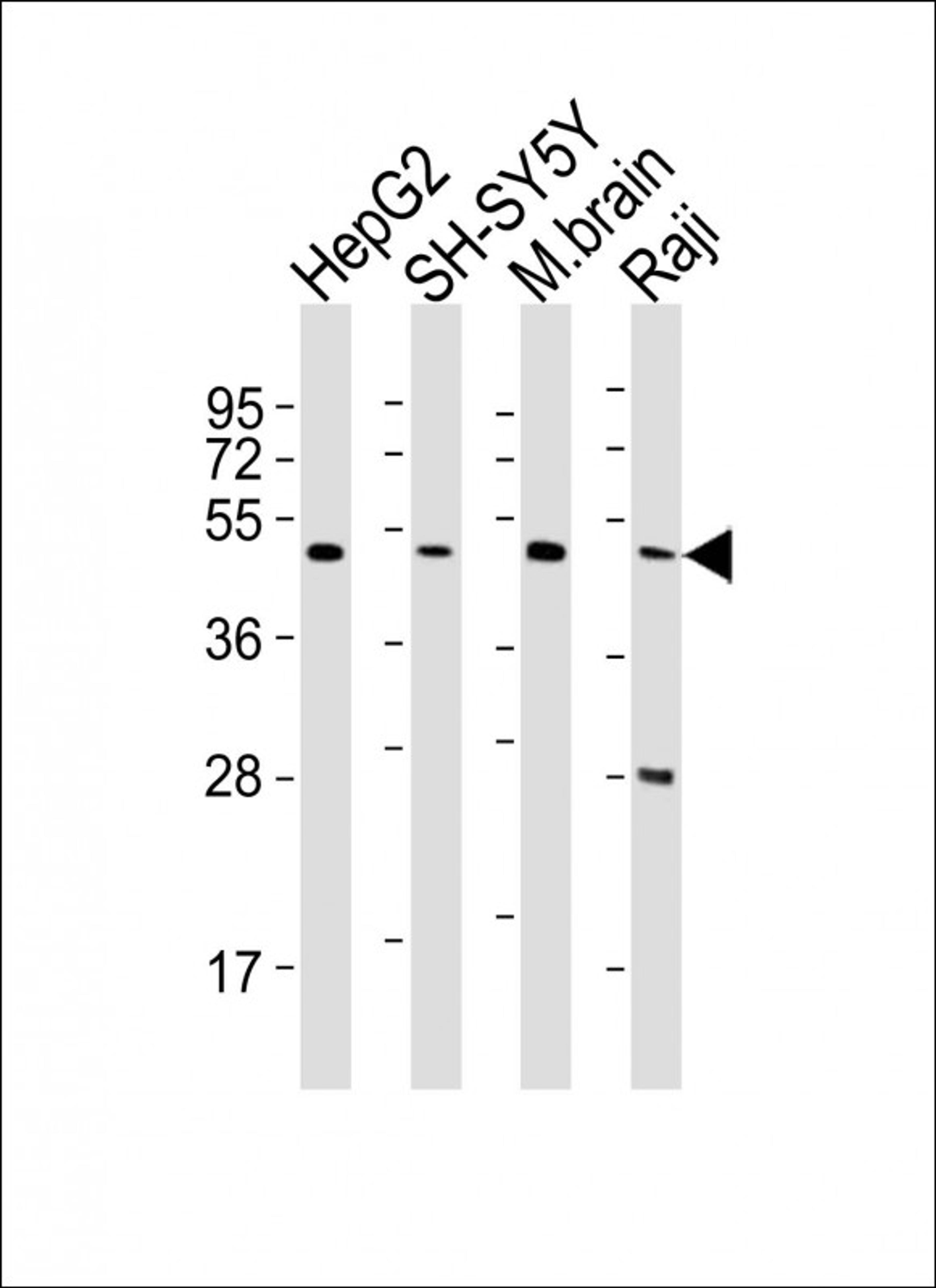 Western Blot at 1:2000 dilution Lane 1: HepG2 whole cell lysates Lane 2: SH-SY5Y whole cell lysates Lane 3: mouse brain lysates Lane 4: Raji whole cell lysates Lysates/proteins at 20 ug per lane.