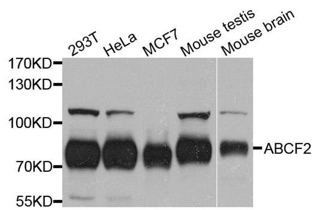 Western blot analysis of extract of various cells using ABCF2 antibody