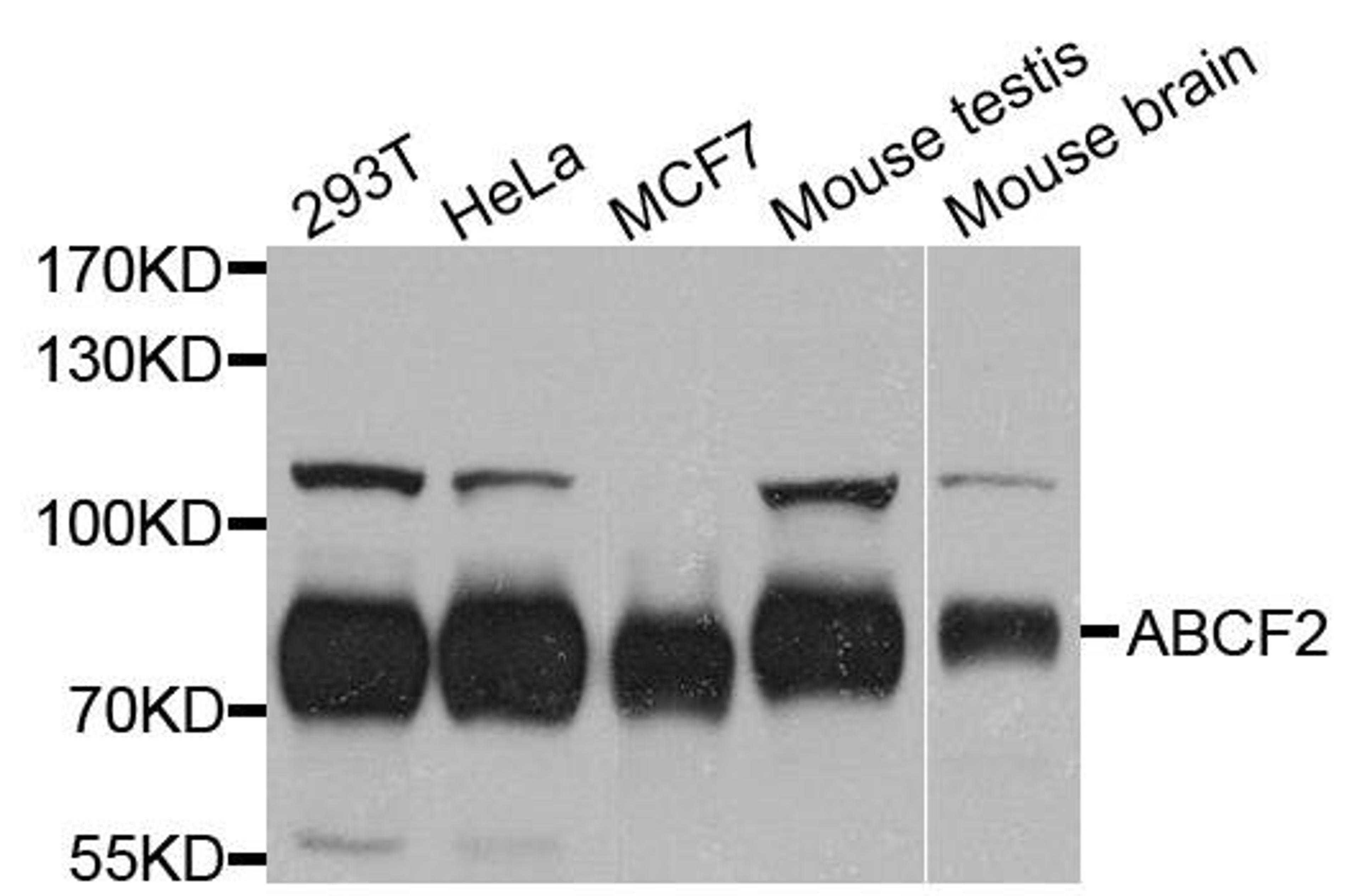 Western blot analysis of extract of various cells using ABCF2 antibody