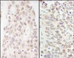 Detection of human and mouse p66beta/GATAD2B by immunohistochemistry.