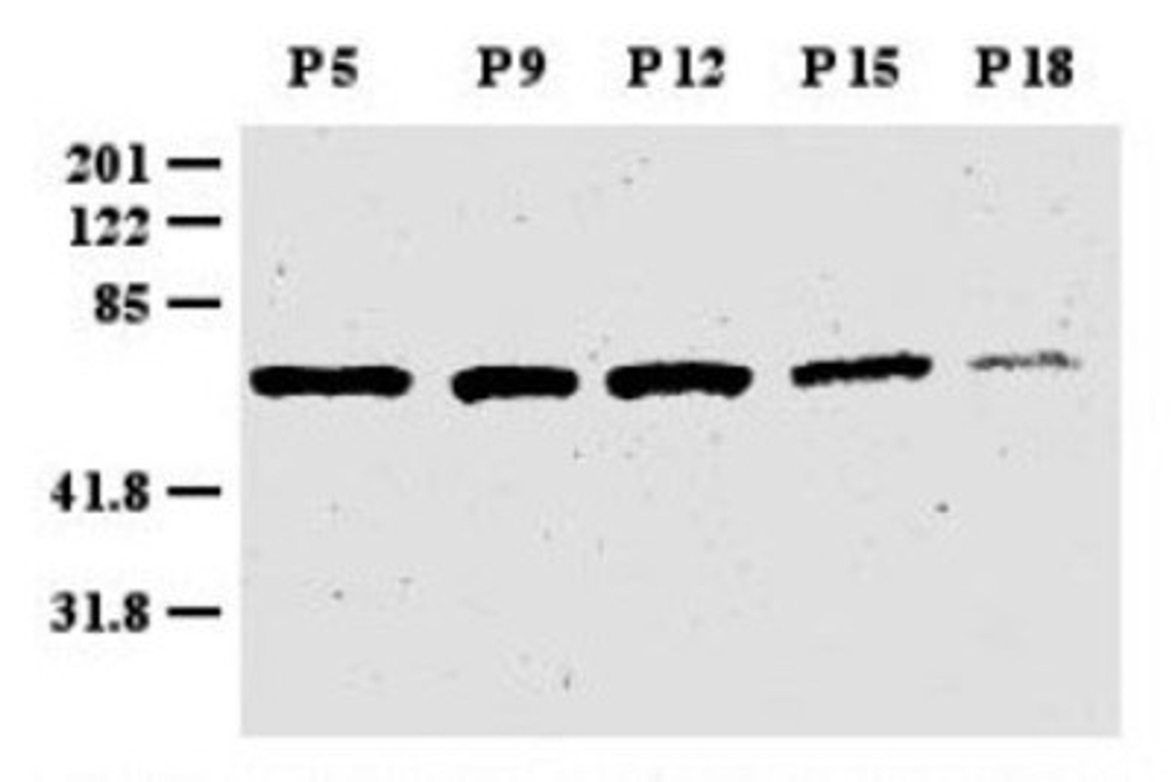 Western Blot: Zic1 Antibody [NB600-488] - Western blot analysis of Zic1 in mouse  cerebellum extract. Protein extracts were prepared from  mouse cerebellum between postnatal day 5 (P5) and P18,  as indicated above the lanes.