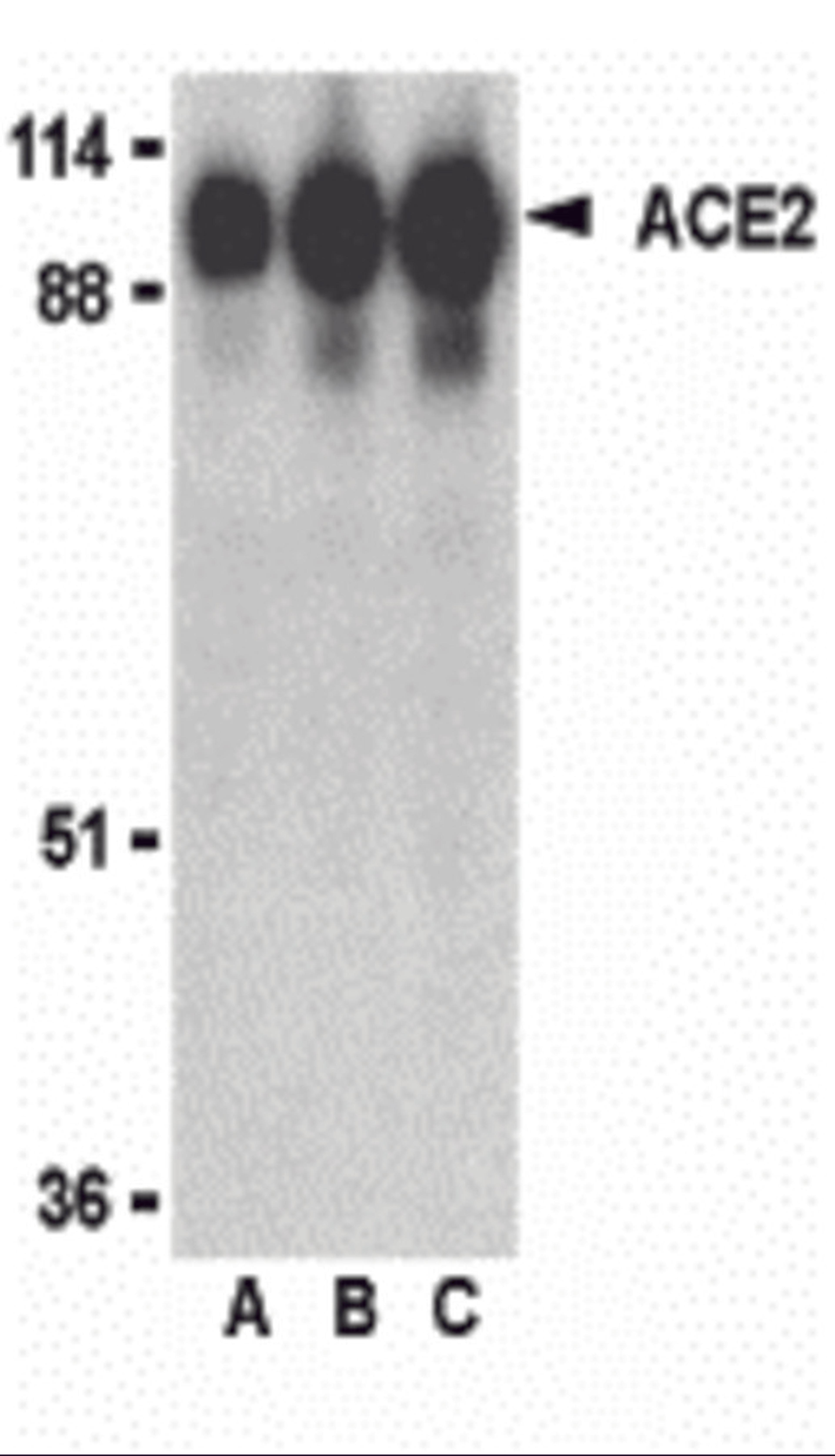 Western blot analysis of ACE2 in human kidney lysate with ACE2 antibody at (A) 0.5, (B) 1 and (C) 2 μg/mL.