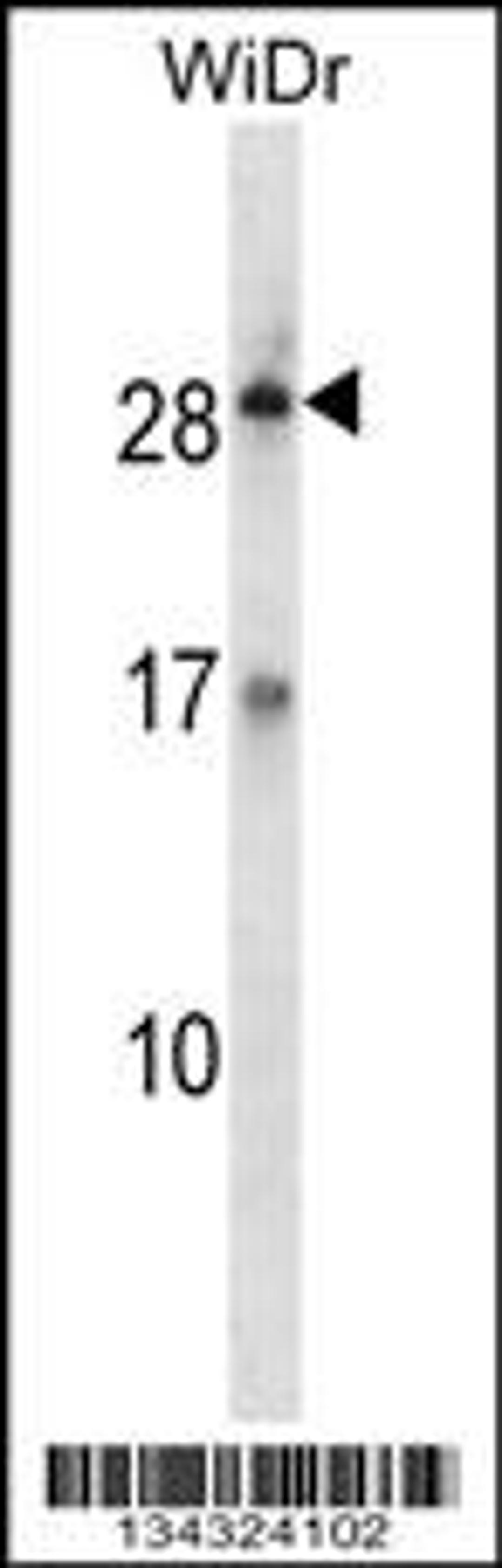 Western blot analysis in WiDr cell line lysates (35ug/lane).