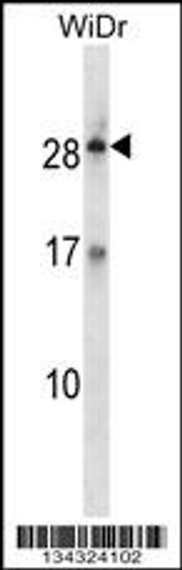 Western blot analysis in WiDr cell line lysates (35ug/lane).