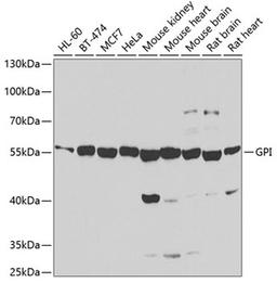 Western blot - GPI antibody (A6916)