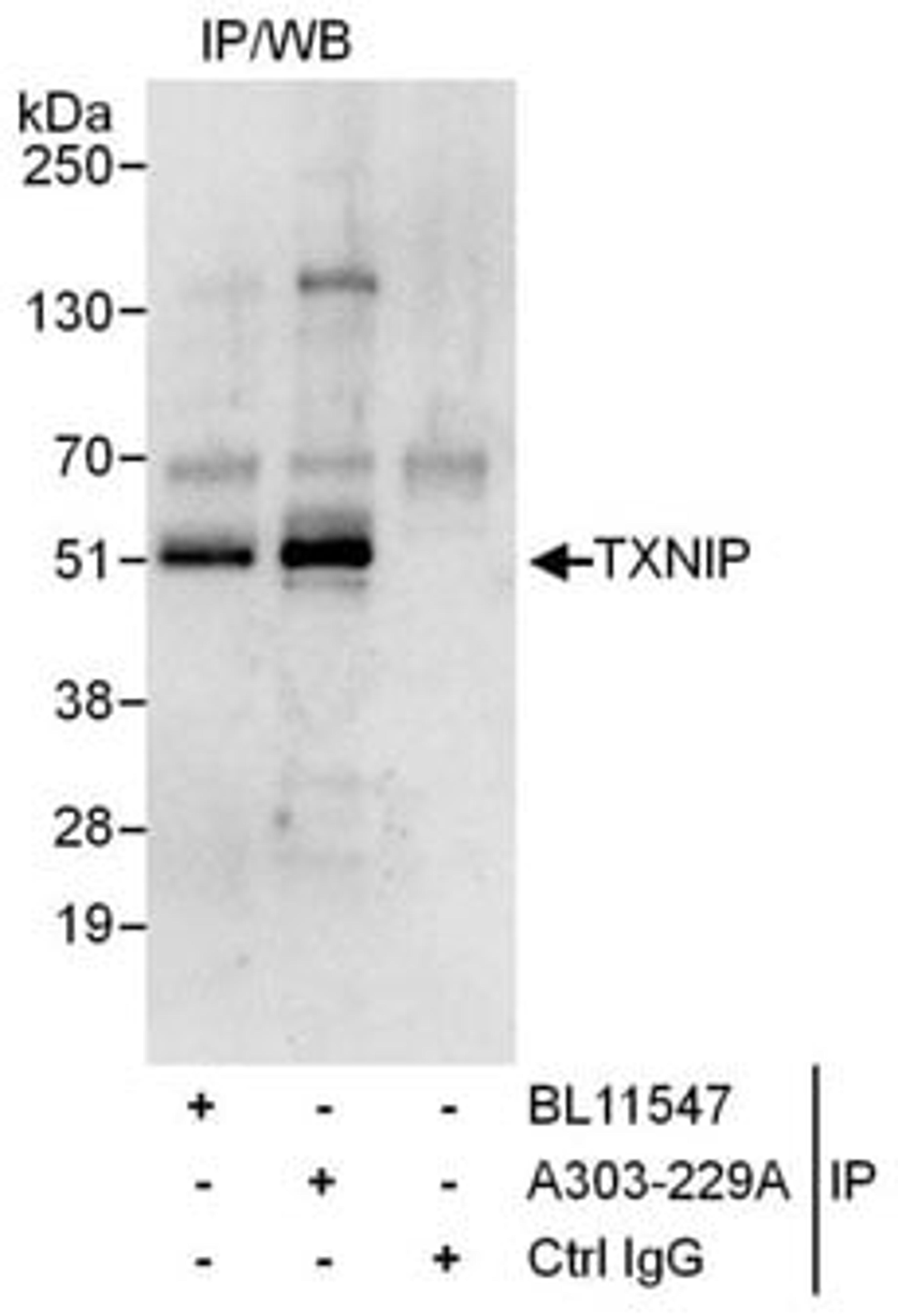 Detection of human TXNIP by western blot of immunoprecipitates.