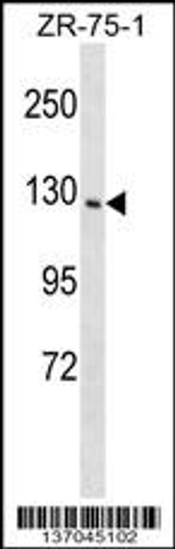 Western blot analysis in ZR-75-1 cell line lysates (35ug/lane).