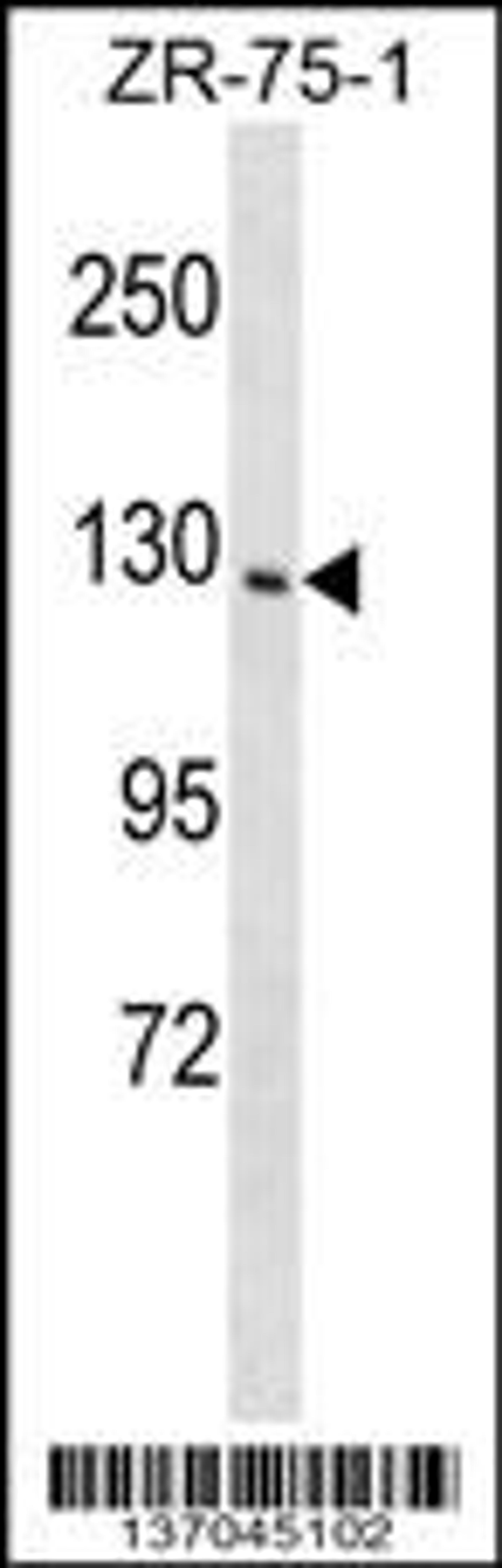 Western blot analysis in ZR-75-1 cell line lysates (35ug/lane).