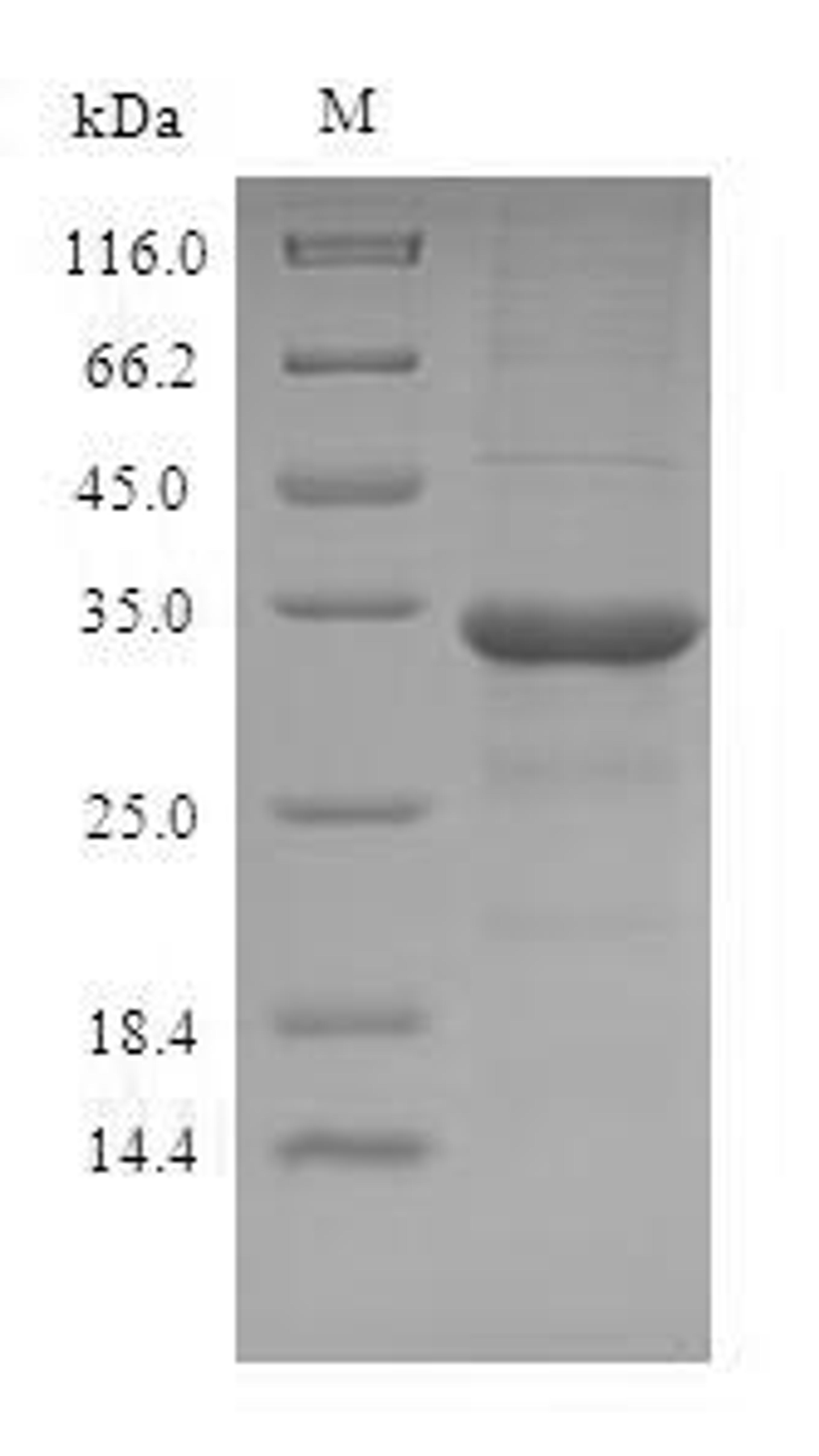 (Tris-Glycine gel) Discontinuous SDS-PAGE (reduced) with 5% enrichment gel and 15% separation gel.