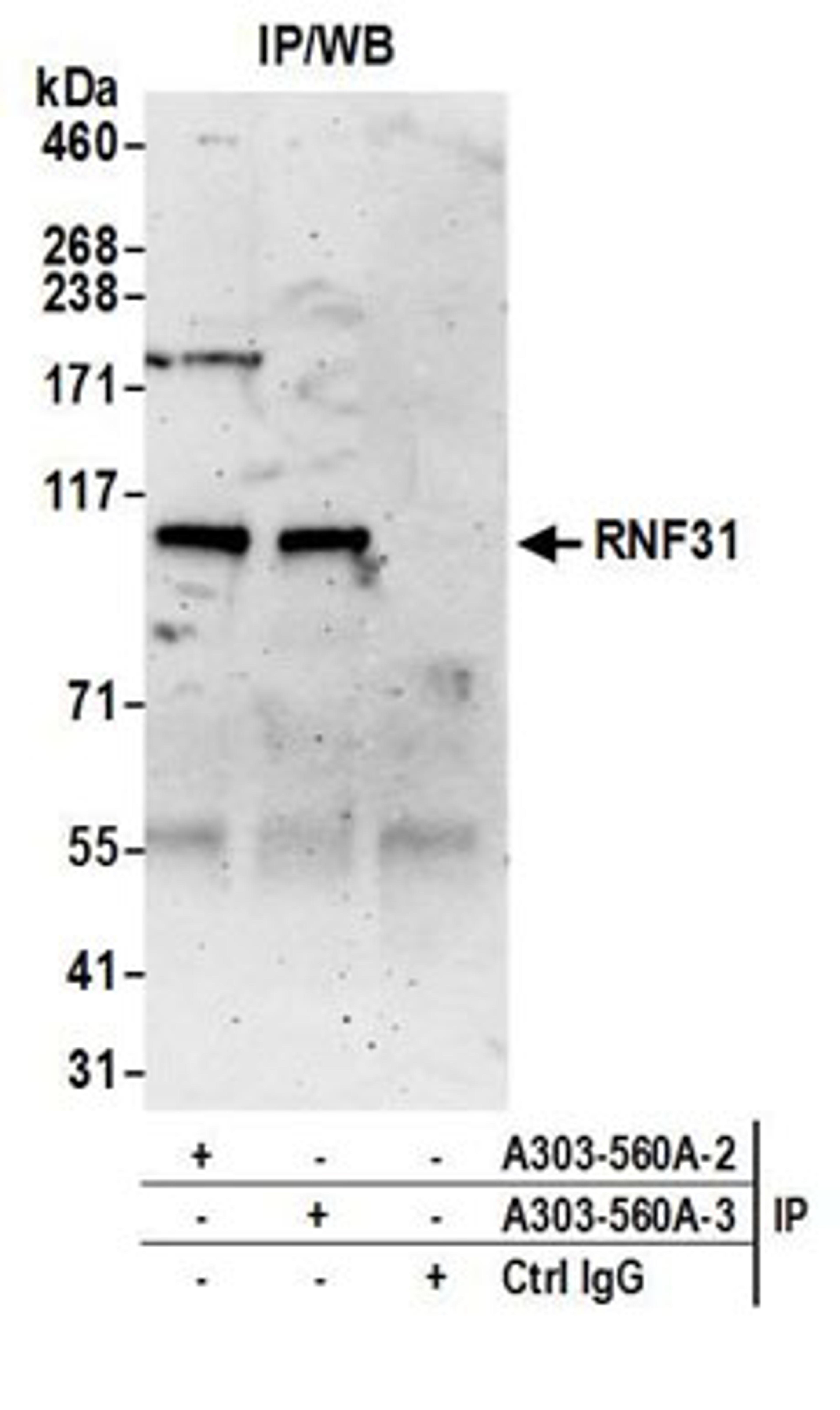 Detection of human RNF31 by western blot of immunoprecipitates.