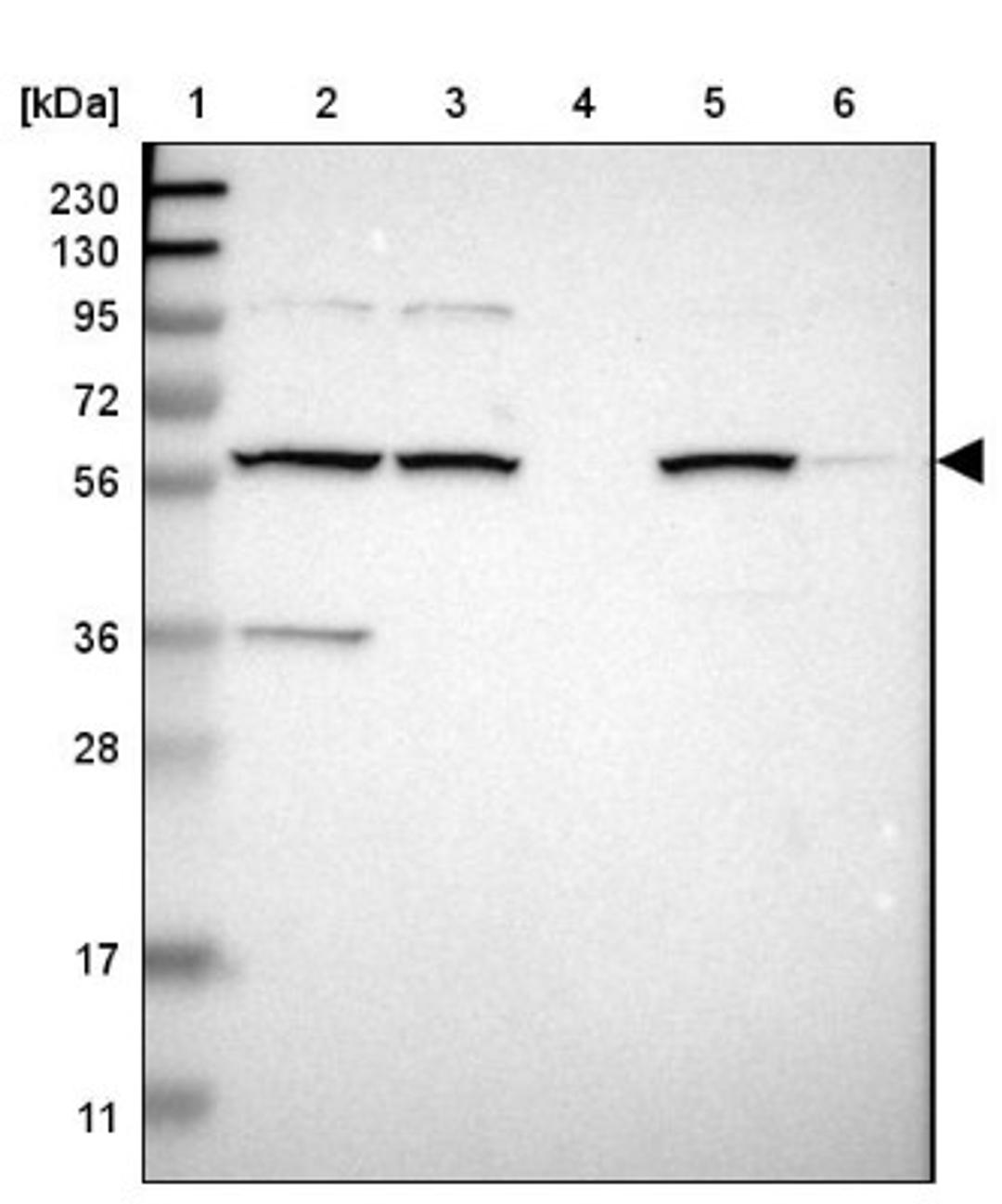 Western Blot: MBOAT2 Antibody [NBP1-82236] - Lane 1: Marker [kDa] 230, 130, 95, 72, 56, 36, 28, 17, 11<br/>Lane 2: Human cell line RT-4<br/>Lane 3: Human cell line U-251MG sp<br/>Lane 4: Human plasma (IgG/HSA depleted)<br/>Lane 5: Human liver tissue<br/>Lane 6: Human tonsil tissue