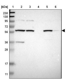 Western Blot: MBOAT2 Antibody [NBP1-82236] - Lane 1: Marker [kDa] 230, 130, 95, 72, 56, 36, 28, 17, 11<br/>Lane 2: Human cell line RT-4<br/>Lane 3: Human cell line U-251MG sp<br/>Lane 4: Human plasma (IgG/HSA depleted)<br/>Lane 5: Human liver tissue<br/>Lane 6: Human tonsil tissue