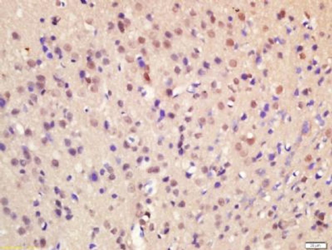 Immunohistochemical staining of rat brain tissue using HOXA7 antibody.