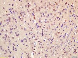 Immunohistochemical staining of rat brain tissue using HOXA7 antibody.