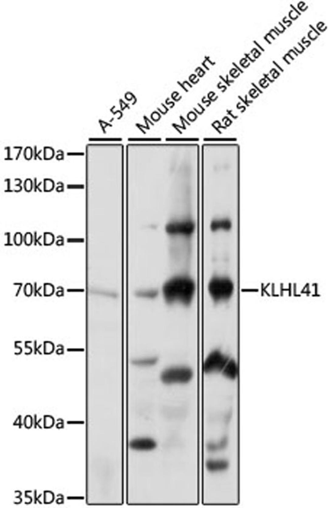 Western blot - KLHL41 antibody (A15383)