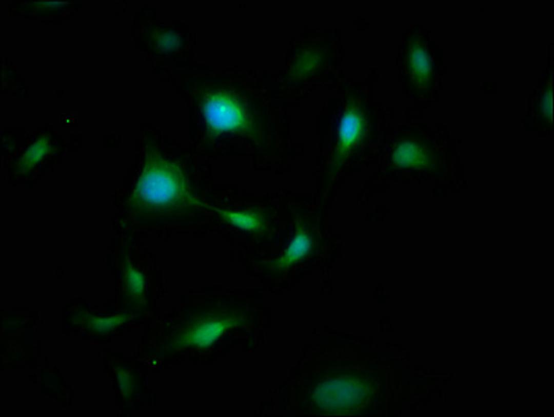 Immunofluorescence staining of U251 cells with CSB-PA009101LA01HU at 1:200, counter-stained with DAPI. The cells were fixed in 4% formaldehyde, permeabilized using 0.2% Triton X-100 and blocked in 10% normal Goat Serum. The cells were then incubated with the antibody overnight at 4&deg;C. The secondary antibody was Alexa Fluor 488-congugated AffiniPure Goat Anti-Rabbit IgG(H+L).