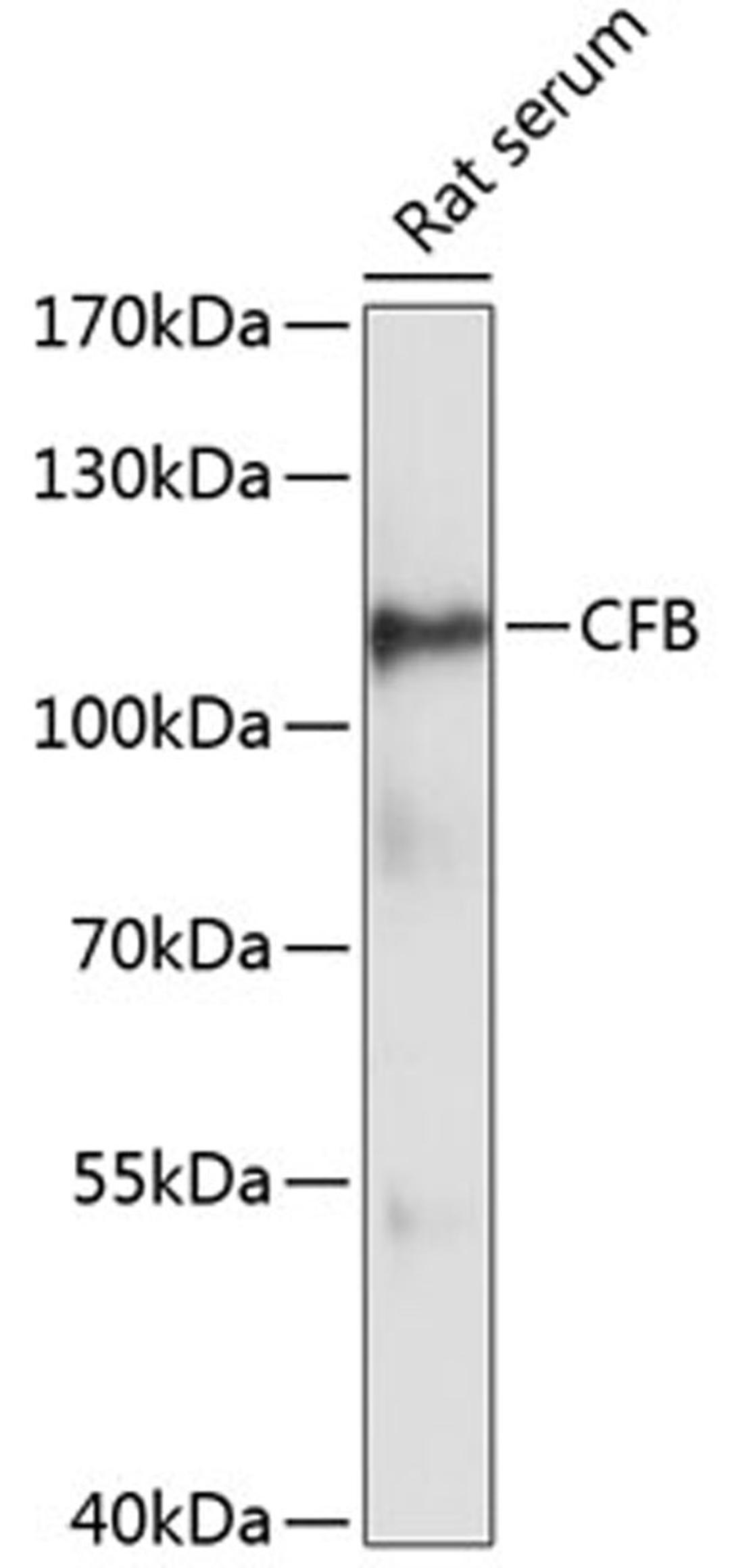 Western blot - CFB antibody (A13243)