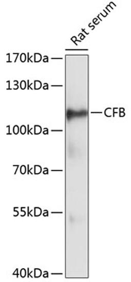 Western blot - CFB antibody (A13243)