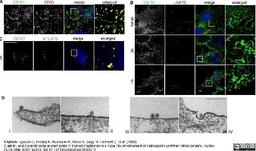 Mouse anti Human CD151 antibody used for the detection of CD151 positive microdomains