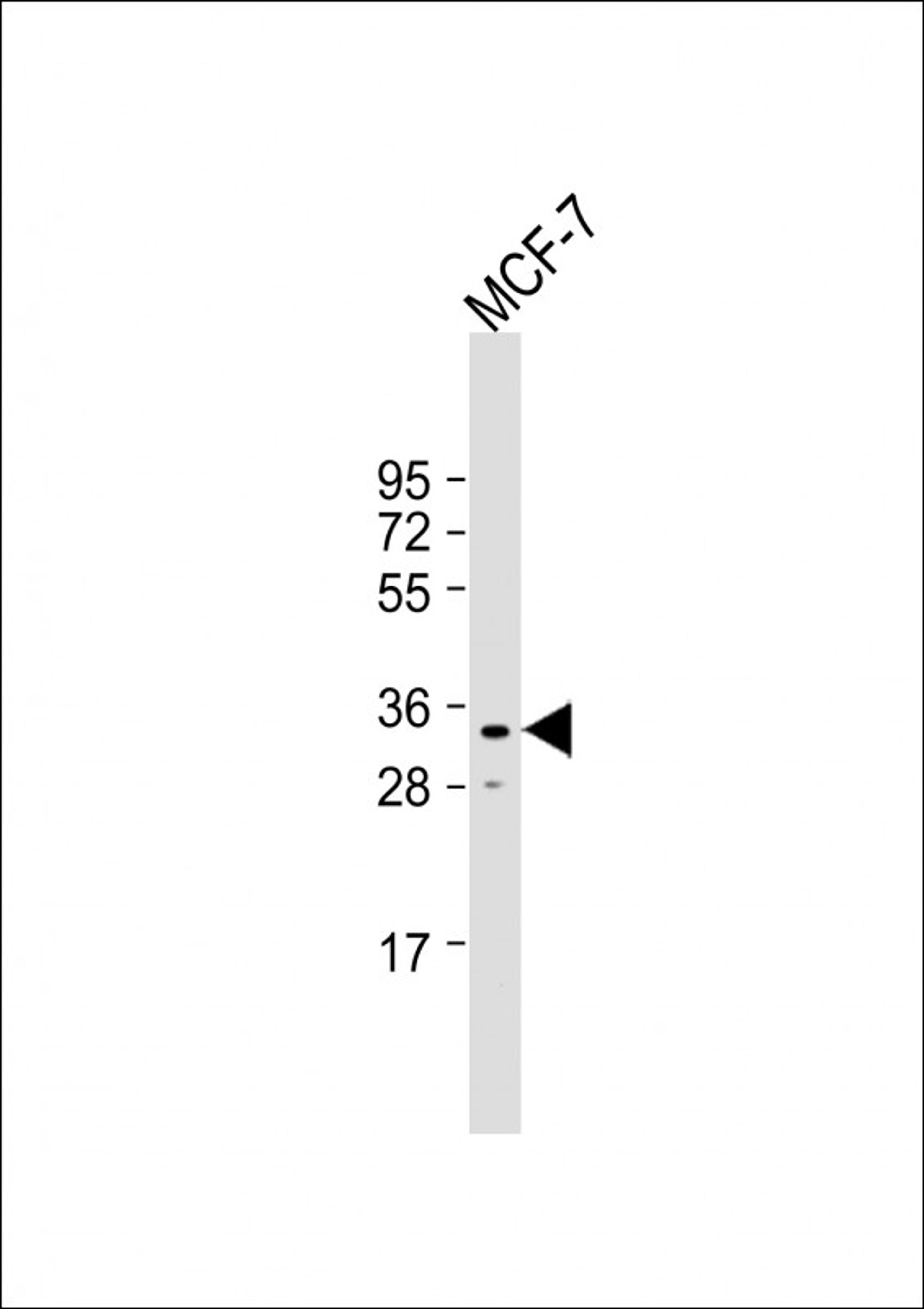 Western Blot at 1:1000 dilution + MCF-7 whole cell lysate Lysates/proteins at 20 ug per lane.