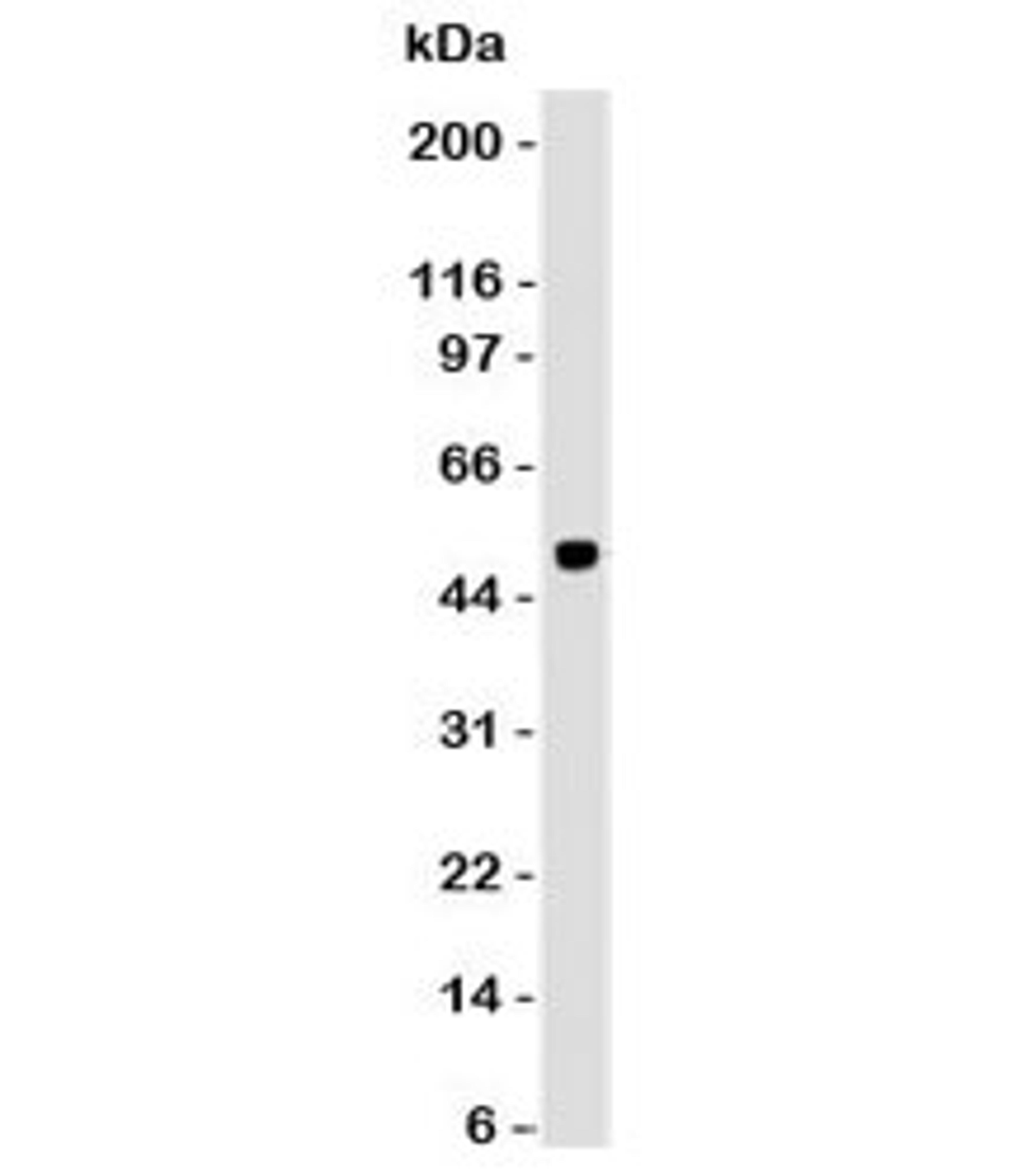 Western blot analysis of human cerebellum and PAX6 antibody. Predicted molecular weight ~46 kDa.