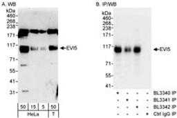 Detection of human EVI5 by western blot and immunoprecipitation.