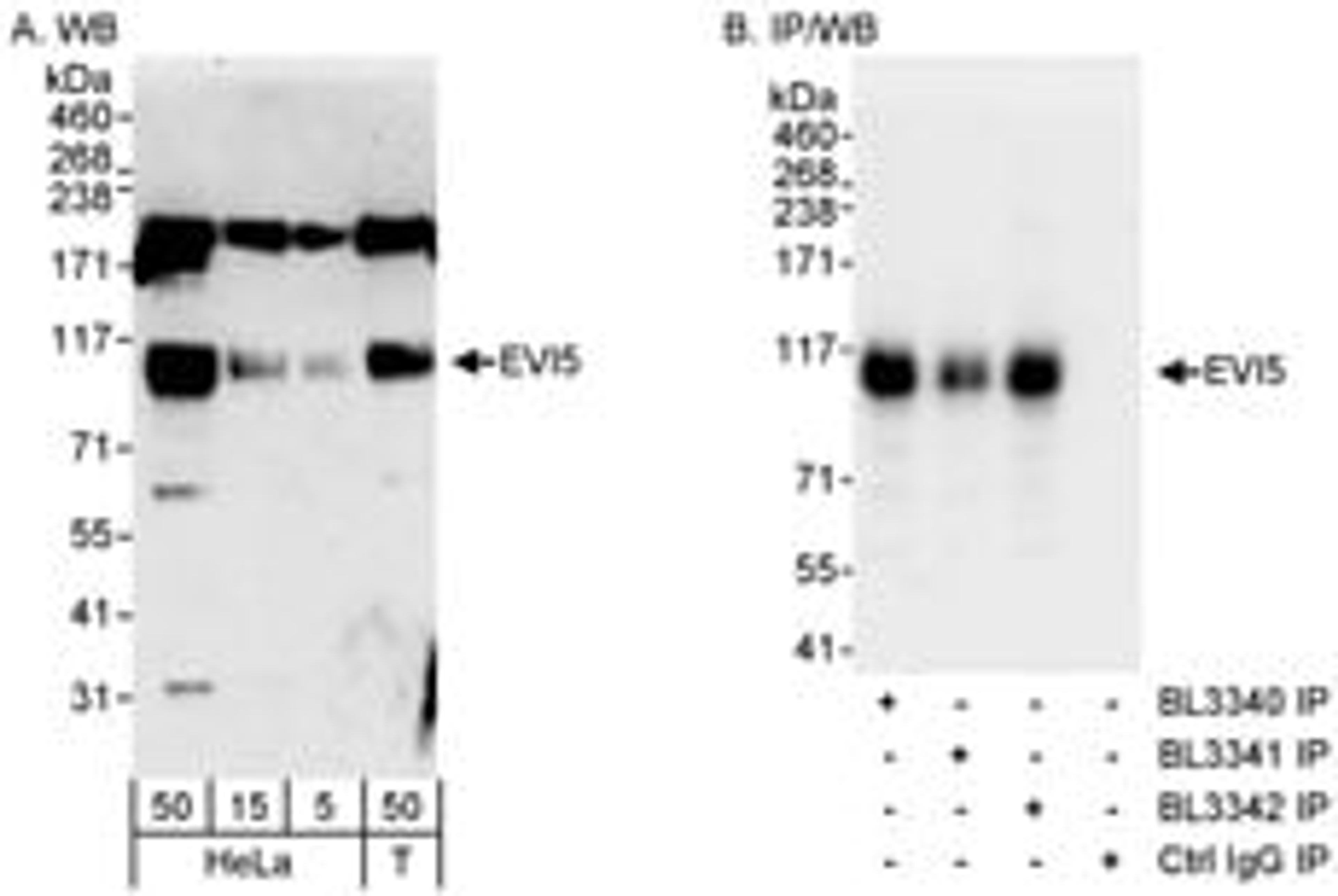 Detection of human EVI5 by western blot and immunoprecipitation.