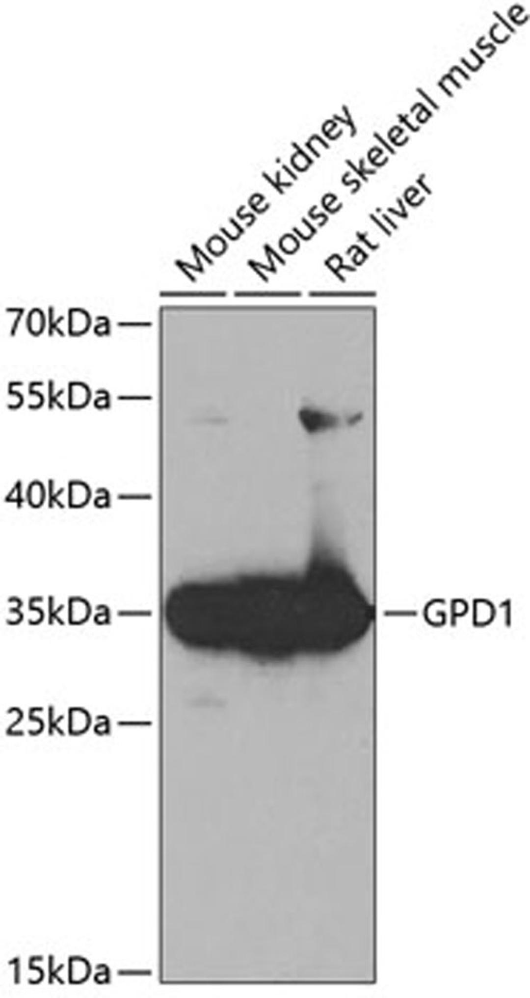 Western blot - GPD1 antibody (A5715)